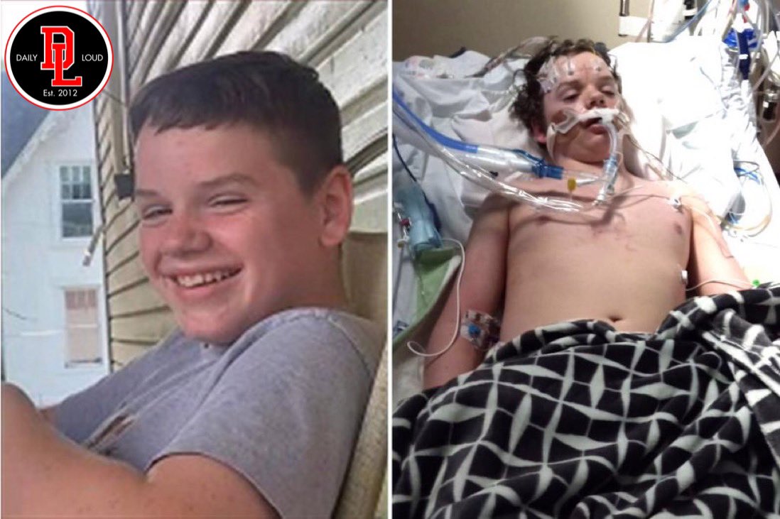 13 years old Jacob in hospital after attempting TikTok stunt